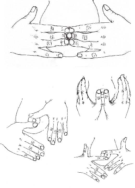 dessins illustrant la technique