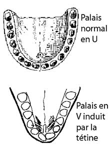 da-42-palais