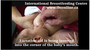 DAL/SNS (Dispositif d'Aide à la Lactation/Système de Nutrition  Supplémentaire)/ dal allaitement ou sns allaitement, aide à l'allaitement.  : : Bébé et Puériculture