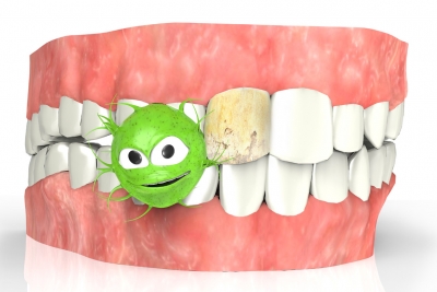 Caries et allaitement : quelques études