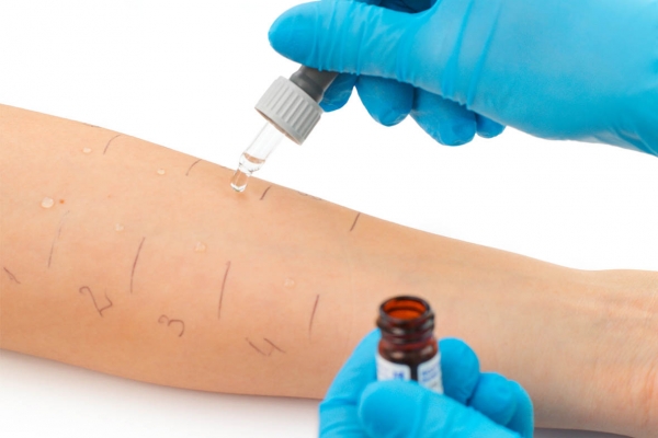 allergie aujourd hui aa 81 allergies et allaitement allergie aujourd hui aa 81 allergies et allaitement
