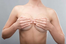 AA 123 : Allaitement et chirurgies mammaires